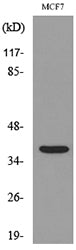 CD79b Rabbit Polyclonal Antibody