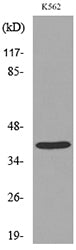CD84 Rabbit Polyclonal Antibody