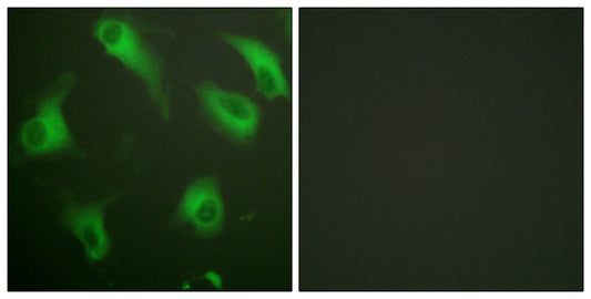 CD88 Rabbit Polyclonal Antibody