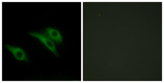 CD9 Rabbit Polyclonal Antibody