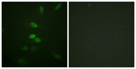 Cdc25B Rabbit Polyclonal Antibody