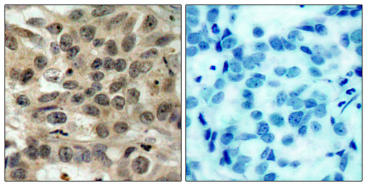 Cdc25C Rabbit Polyclonal Antibody