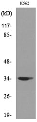 Cdc34 Rabbit Polyclonal Antibody