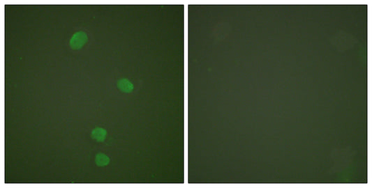 CDC46 Rabbit Polyclonal Antibody