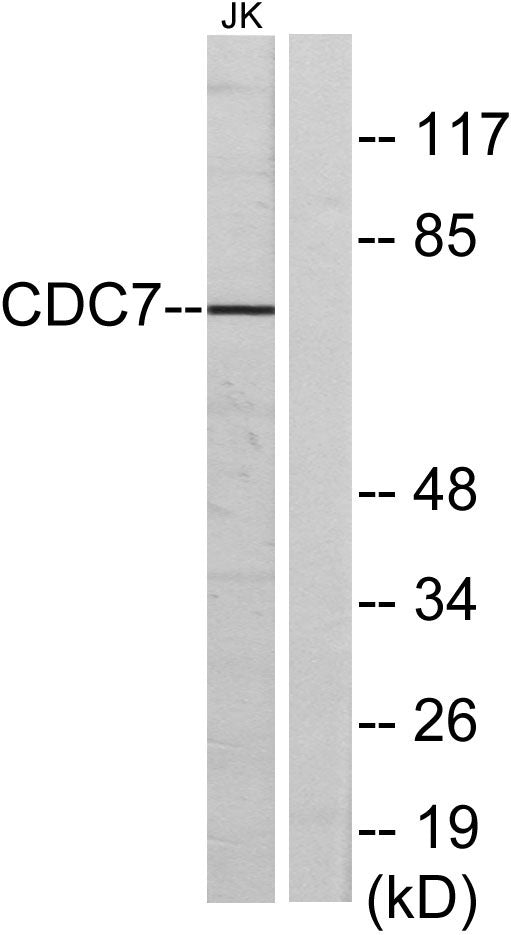 Cdc7 Rabbit Polyclonal Antibody