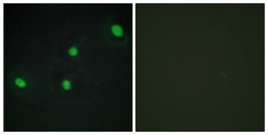 CdcA4 Rabbit Polyclonal Antibody