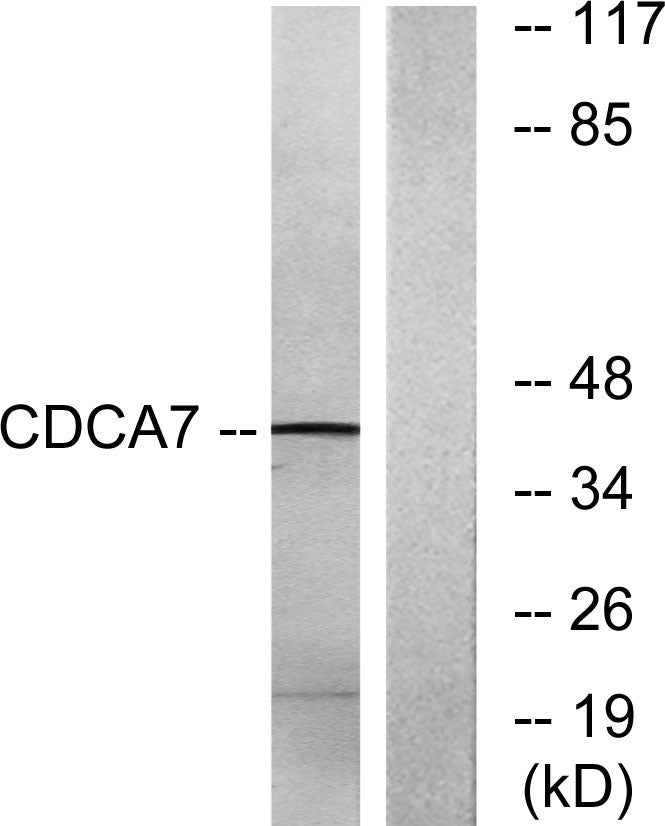 CdcA7 Rabbit Polyclonal Antibody
