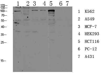 CDH17 Rabbit Polyclonal Antibody