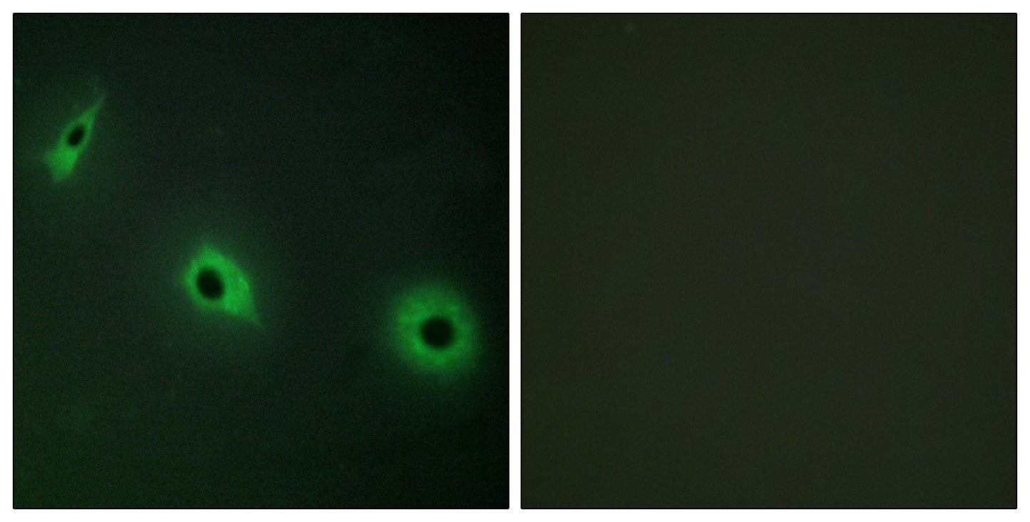 CDHF11 Rabbit Polyclonal Antibody