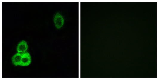 CDHF9 Rabbit Polyclonal Antibody