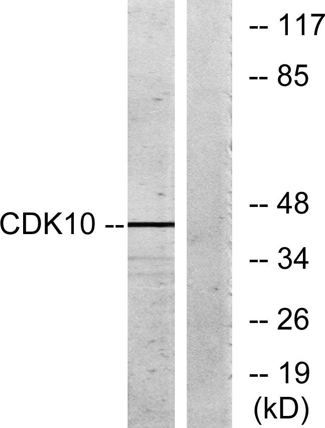Cdk10 Rabbit Polyclonal Antibody