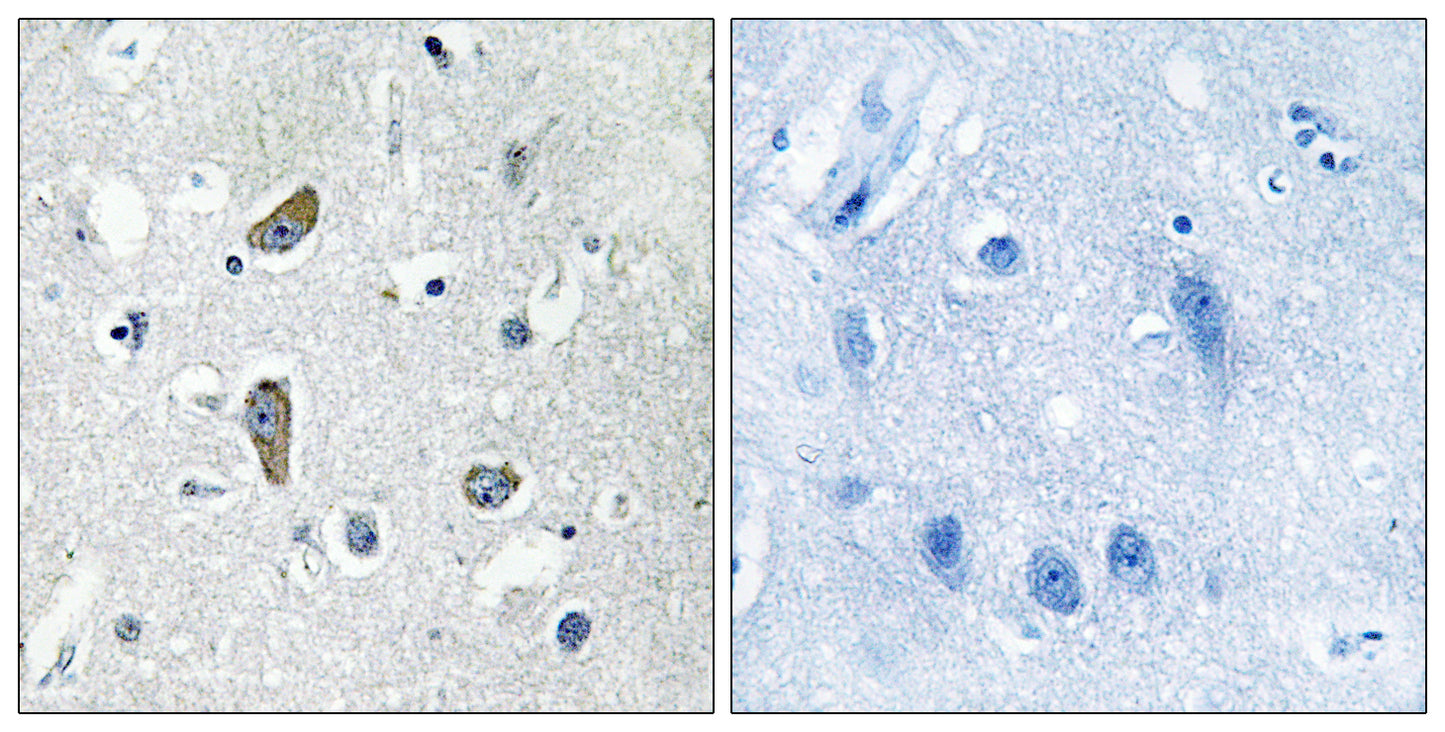 CDK5 Activator-binding C48 Rabbit Polyclonal Antibody