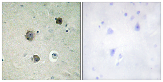 Cdk5 Rabbit Polyclonal Antibody