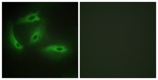 CdkL4 Rabbit Polyclonal Antibody
