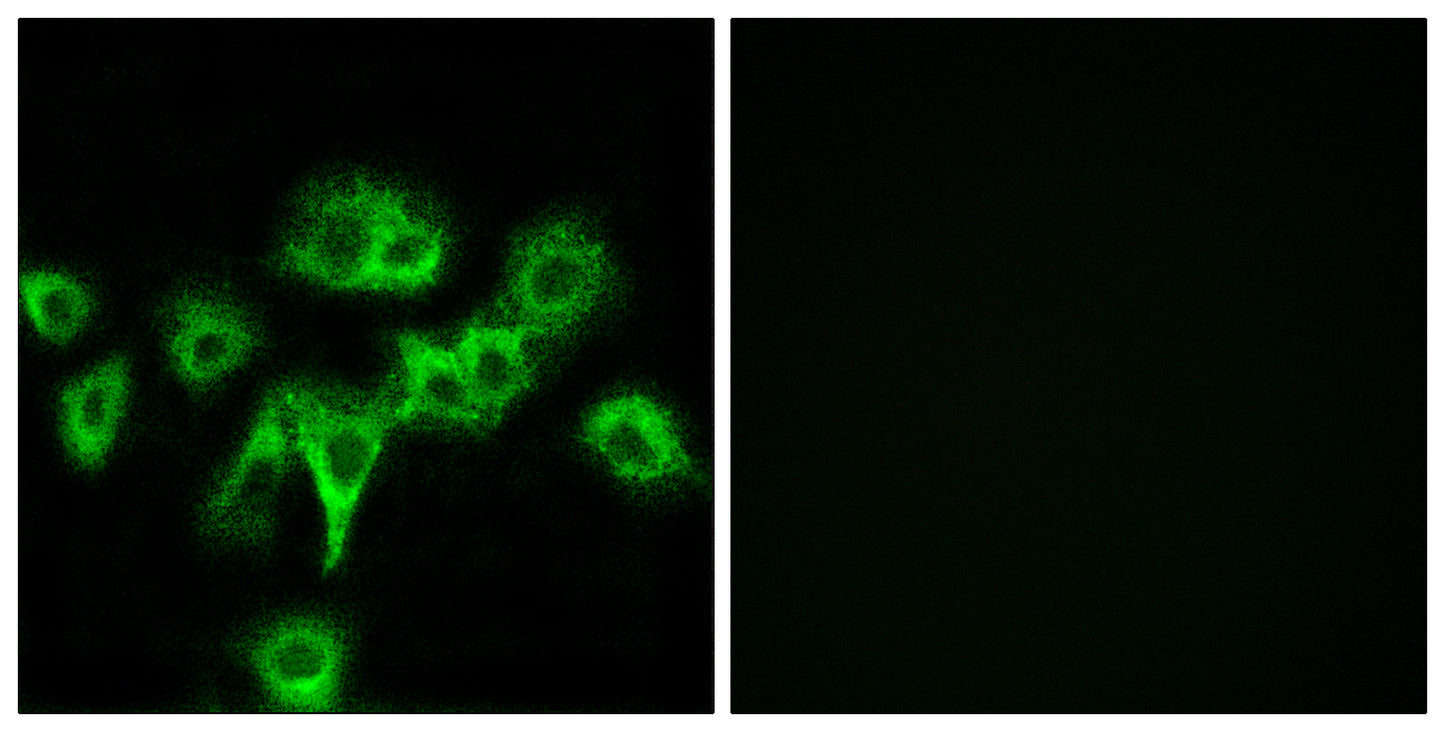 CDO Rabbit Polyclonal Antibody