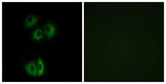 CELSR3 Rabbit Polyclonal Antibody