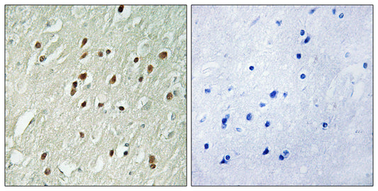 Centrobin Rabbit Polyclonal Antibody