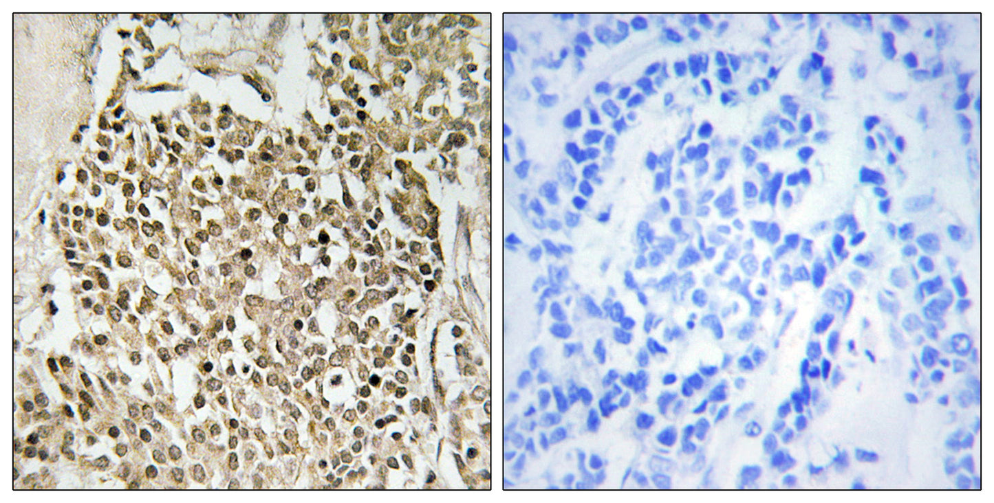 CEP350 Rabbit Polyclonal Antibody