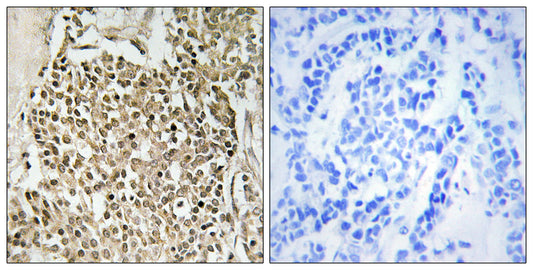 CEP350 Rabbit Polyclonal Antibody