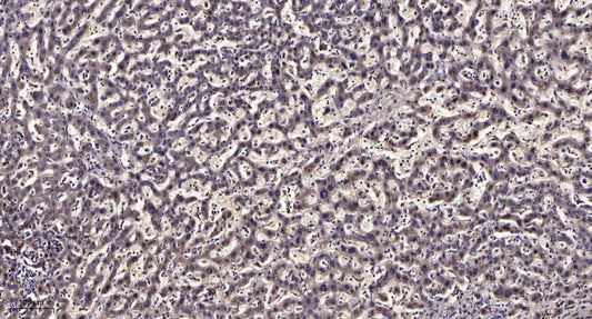 CEP41 Rabbit Polyclonal Antibody
