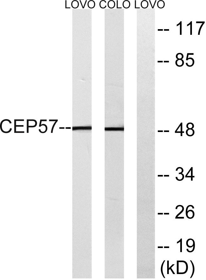 CEP57 Rabbit Polyclonal Antibody