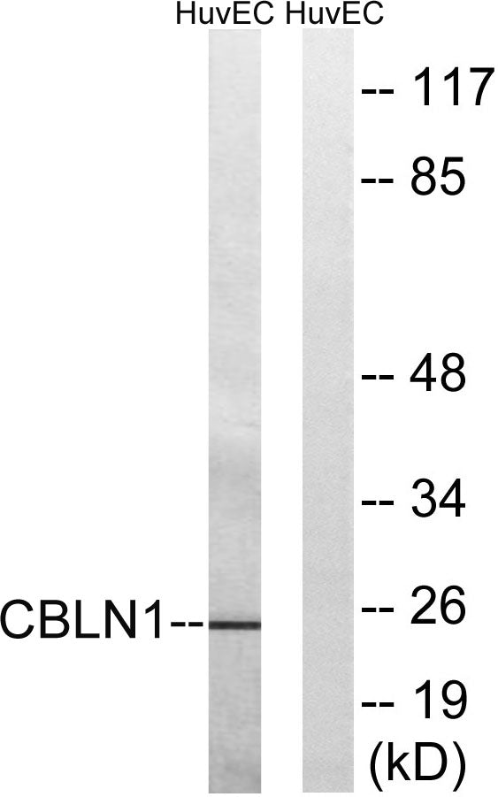 Cerebellin 1 Rabbit Polyclonal Antibody