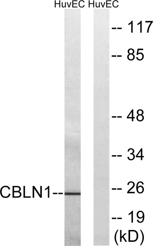 Cerebellin 1 Rabbit Polyclonal Antibody