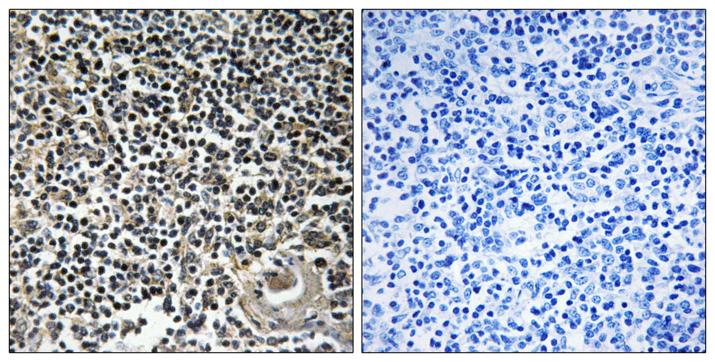 Cerebellin 4 Rabbit Polyclonal Antibody