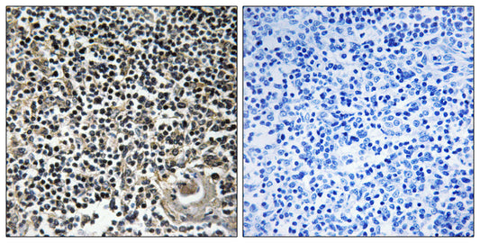 Cerebellin 4 Rabbit Polyclonal Antibody