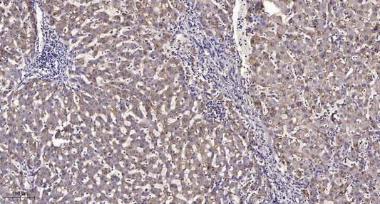 CES2 Rabbit Polyclonal Antibody