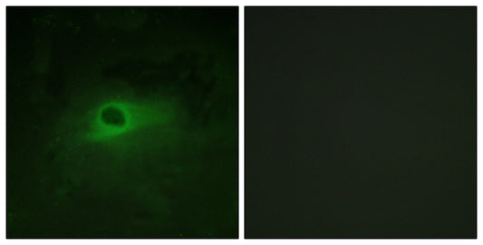 c-Fms Rabbit Polyclonal Antibody