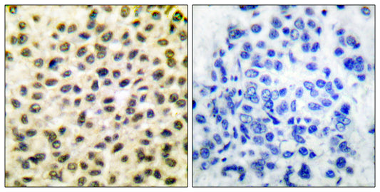 c-Fos Rabbit Polyclonal Antibody
