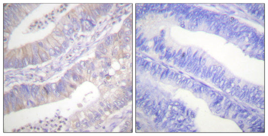 CFTR Rabbit Polyclonal Antibody