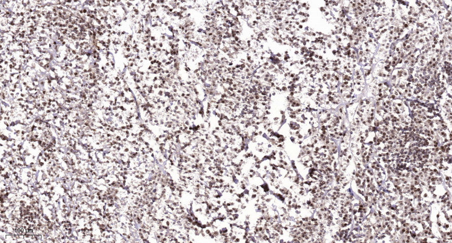 CGGBP1 Rabbit Polyclonal Antibody
