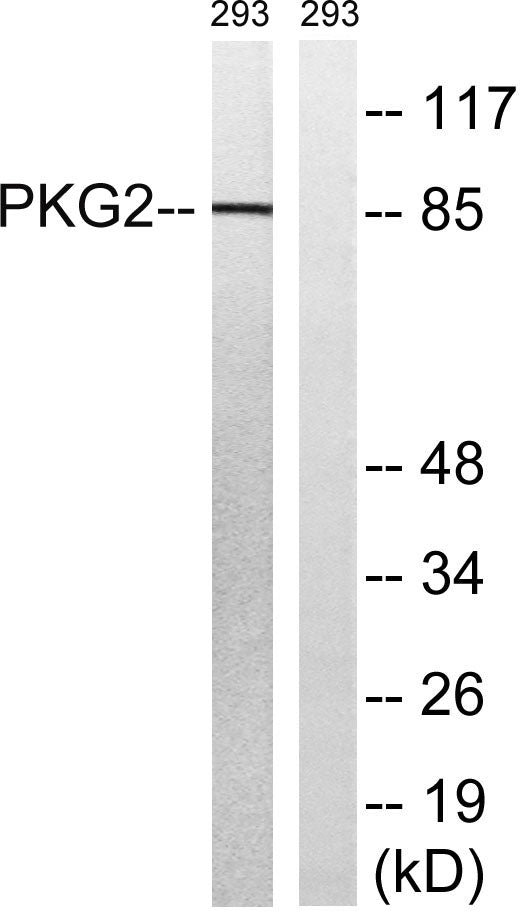 cGKII Rabbit Polyclonal Antibody