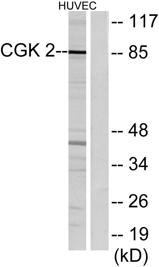 cGKII Rabbit Polyclonal Antibody