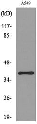 CGR19 Rabbit Polyclonal Antibody