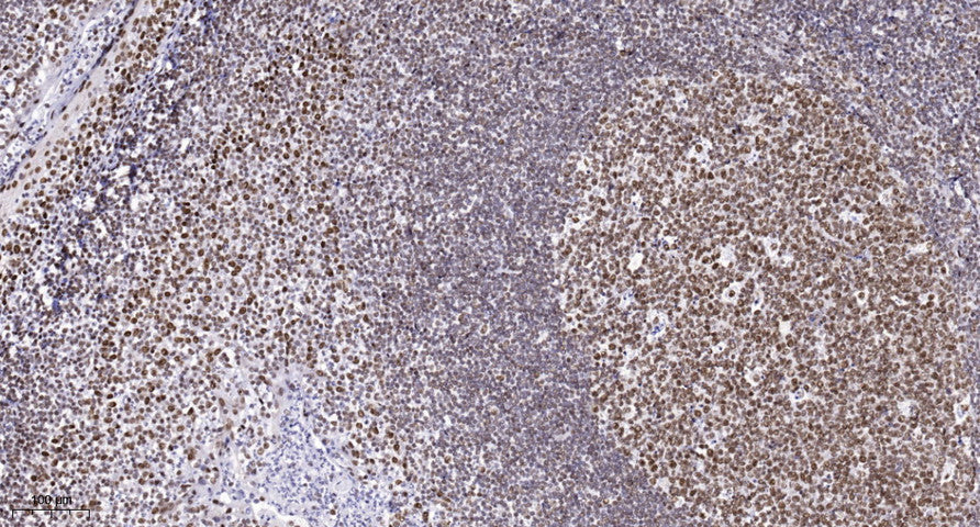 CHD6 Rabbit Polyclonal Antibody