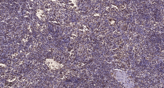 CHD8 Rabbit Polyclonal Antibody