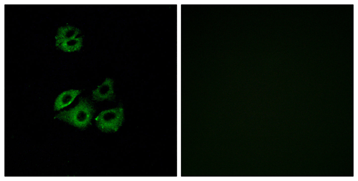 Chemokine Receptor D6 Rabbit Polyclonal Antibody