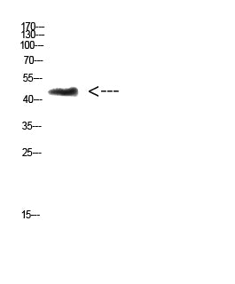 CHID1 Rabbit Polyclonal Antibody