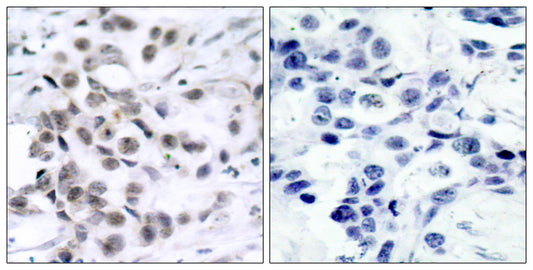 Chk1 Rabbit Polyclonal Antibody