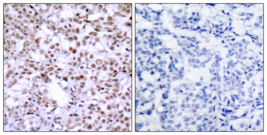Chk2 Rabbit Polyclonal Antibody