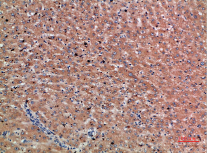 Chordin Rabbit Polyclonal Antibody