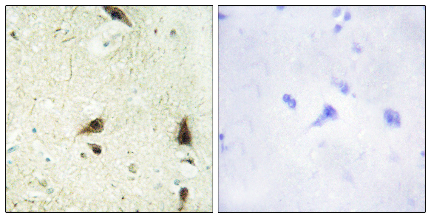 CHRAC15 Rabbit Polyclonal Antibody