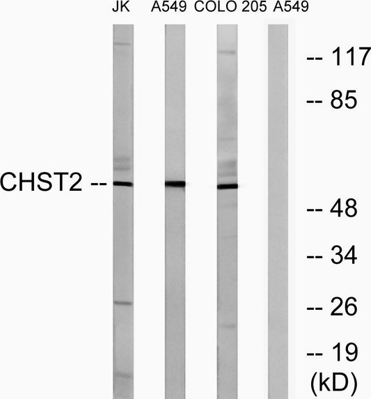 CHST2 Rabbit Polyclonal Antibody
