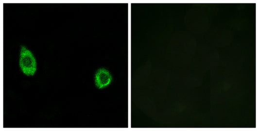 CHST9 Rabbit Polyclonal Antibody