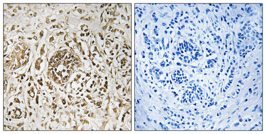 CIB2 Rabbit Polyclonal Antibody