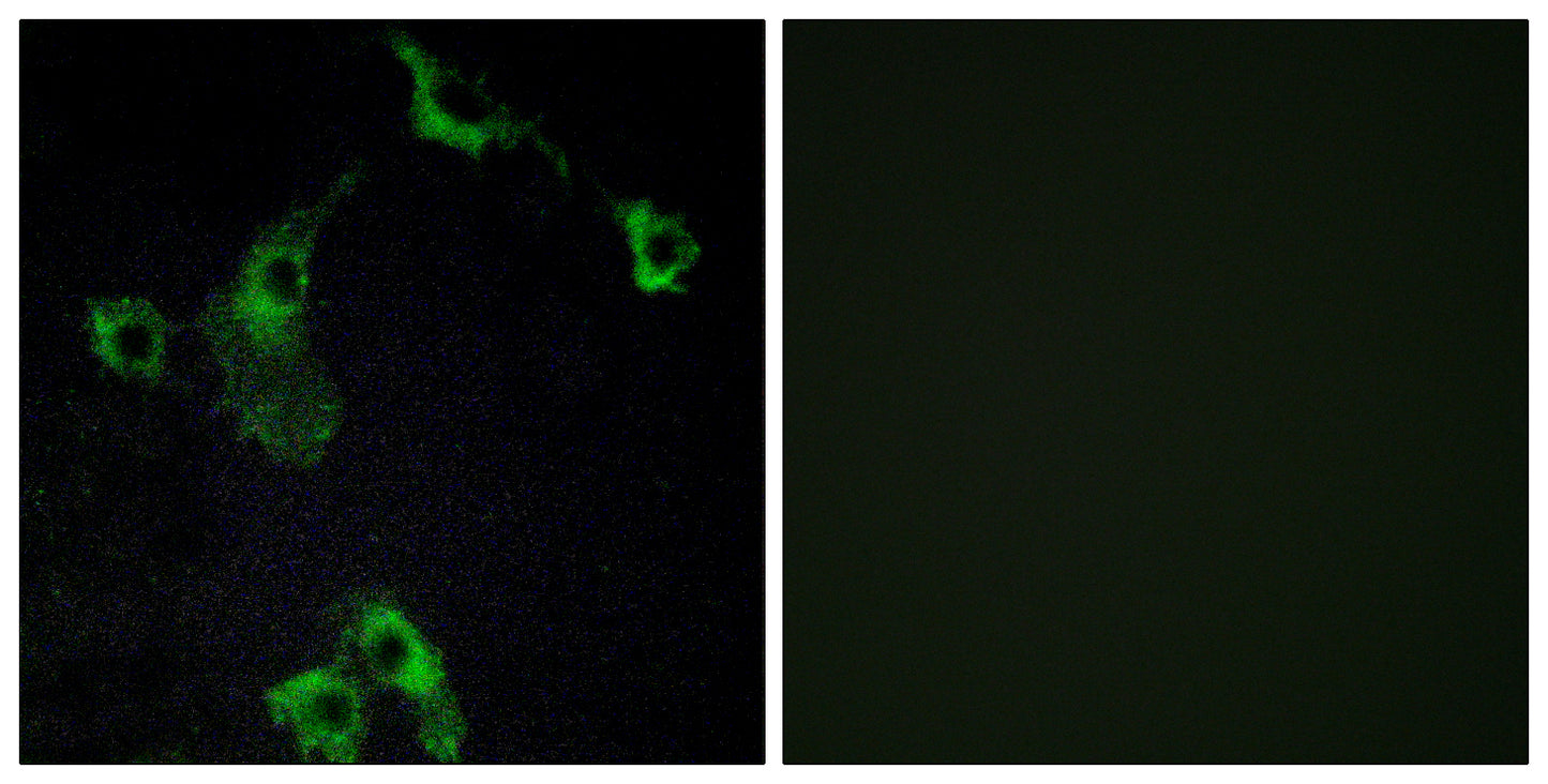 CIDE-B Rabbit Polyclonal Antibody