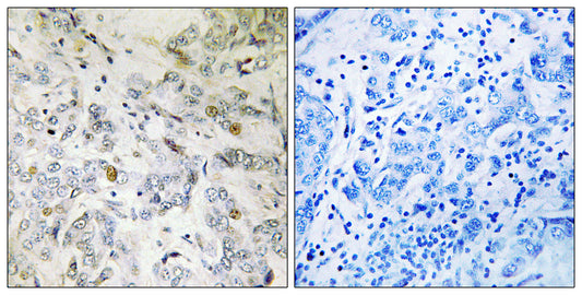 CIP29 Rabbit Polyclonal Antibody